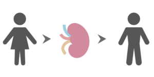 weergave van een niertransplantatie is picogrammen