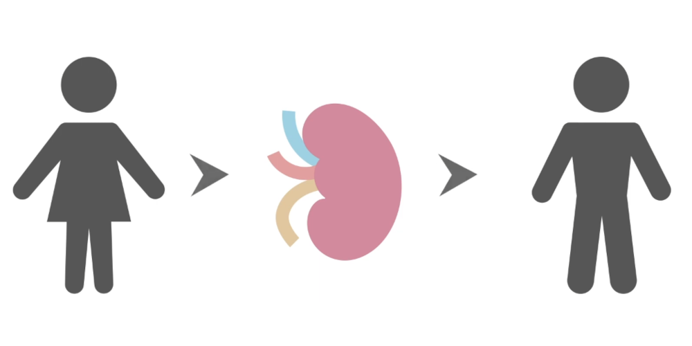 weergave van een niertransplantatie is picogrammen